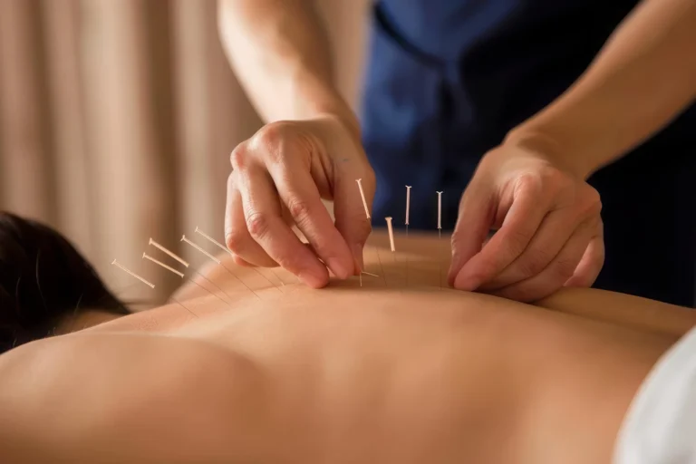 Close-up of a practitioner inserting thin acupuncture needles into a person’s bare back during a therapeutic treatment session.