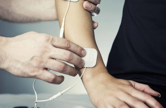 Close-up of a therapist applying electrode pads to a patient’s arm for electrical stimulation therapy, commonly used in physiotherapy treatments.
